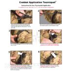 Турникет BCB Combat Tourniquet Black - Черен » Dulotec.BG